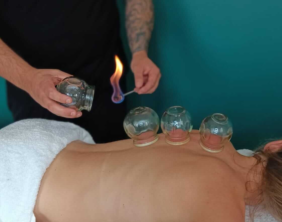 Masażysta stawiający bańki ogniowe